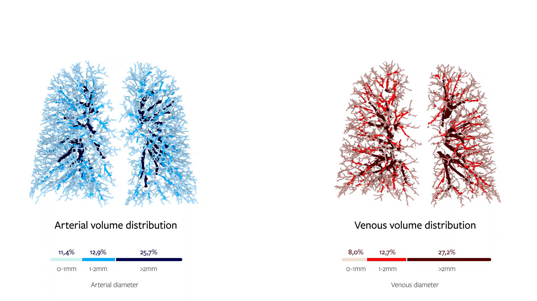 Figure 2 Pulmonary arterial and venous volume distribution and measurements