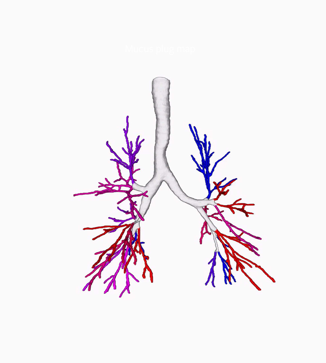 Bronchial wall thickness quantification