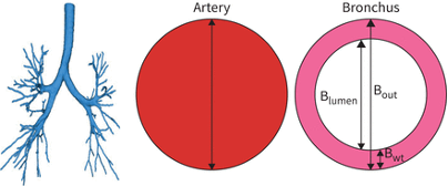 segments of bronchial tree